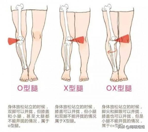 過氣&OpenCurlyDoubleQuote;老爹褲&rdquo;又重新火了！4種穿法讓你精緻又高階，明星都上頭
