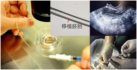 今天是“世界胚胎學家日”，圖文揭秘試管嬰兒的全過程