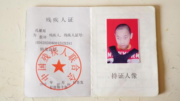 早產兒出生時體重僅重2斤8兩,因患重症遭父母遺棄,奶奶捨命相救 早產兒出生時體重僅重2斤8兩,因患重症遭父母遺棄,奶奶捨命相救