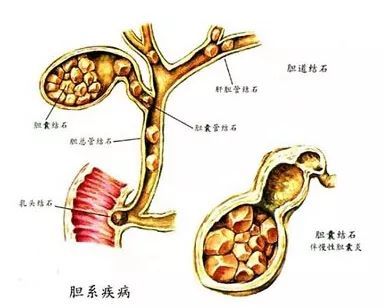 他19年前切了膽，到了今天只有一個想法：請把我的膽還給我