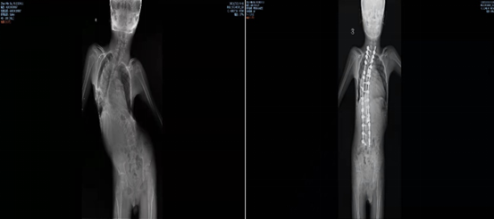誤診、缺藥、費用昂貴，2000萬罕見病患者的診療困境