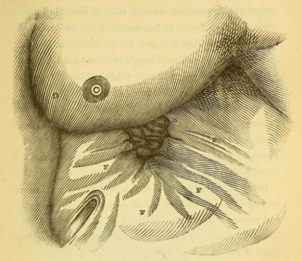 8年完成了238次人體實驗，胃部留洞58年，聖馬丁承受苦難造福人類