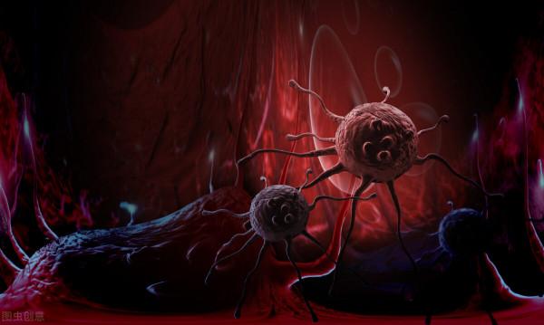 “省、懶、怕、作”，癌症最喜歡四種人，有這些陋習當心癌症找上門