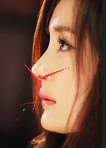 內娛“假鼻子”大PK，誰的假到逆天，誰的越整越殘？