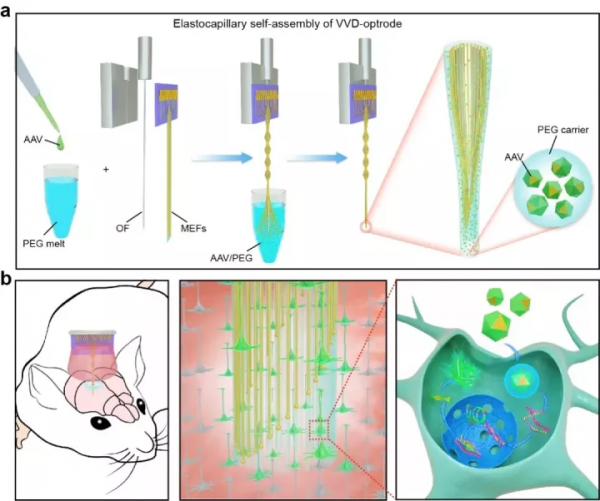 腦科學日報:慢性頸痛不僅傷身而且傷腦 腦科學日報:慢性頸痛不僅傷身而且傷腦