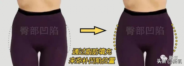 第一次聽說走路也能吸粉? 第一次聽說走路也能吸粉?