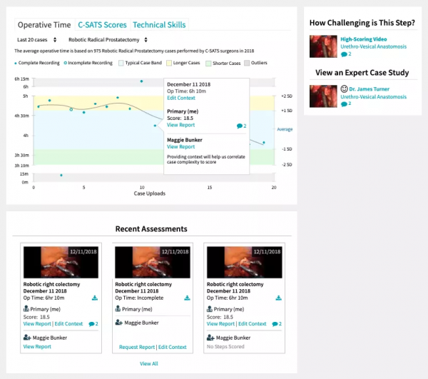 強生微軟聯手！手術機器人打響數字戰