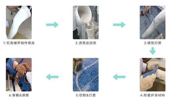 三種康復輔具3D列印材料及其應用