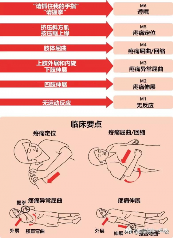 「乾貨」昏迷患者的評估量表及處置流程