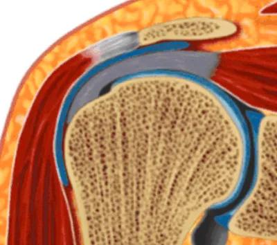 “肩膀痛”！元兇4找到了