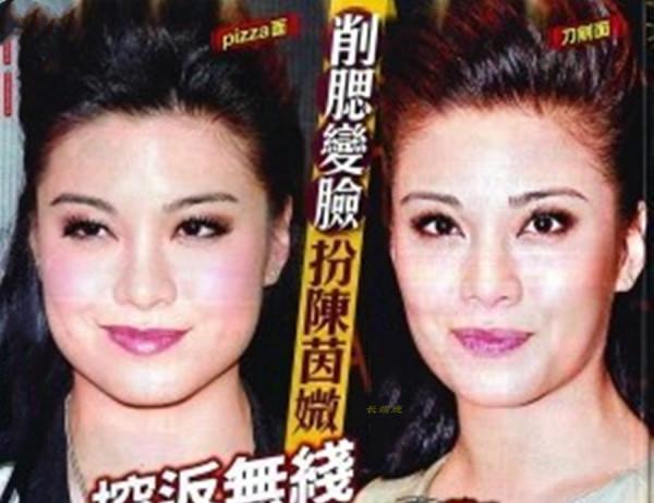 追求“V”字臉的明星真的是“少時不懂方臉好，到了中年才醒悟”