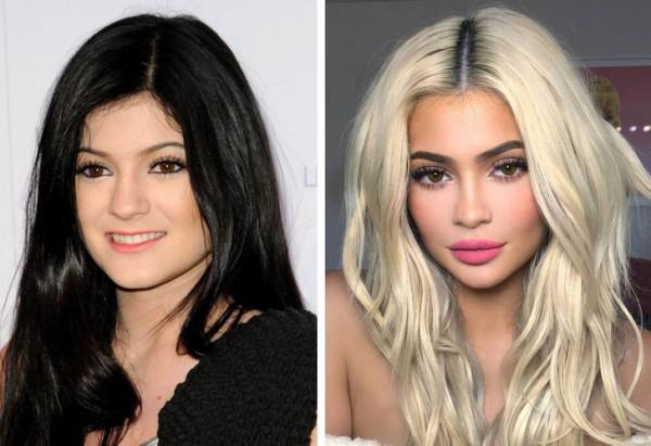 在轉向整形外科手術之前，10位明星真實的樣子，簡直面目全非