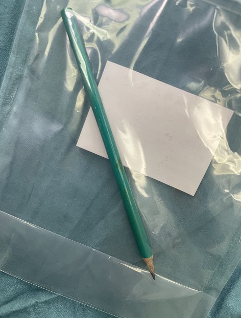 太嚇人！寫作業時父子起爭執，鉛筆竟插入8歲男孩後腦勺