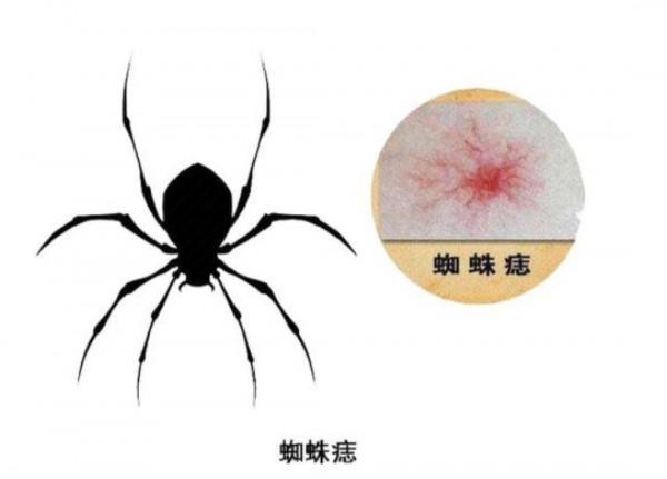 身上出現很多小紅點，不痛不癢是怎麼回事？這些病別心存僥倖