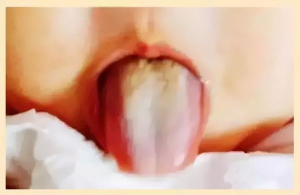 地圖舌背後的慘痛經歷！沒有自以為是的愛，就沒有傷害