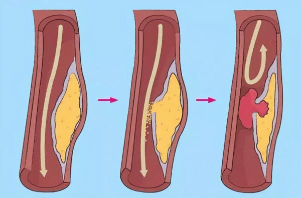 一動心口就疼不一定是外傷所致 還有可能是這些疾病導致的 一動心口就疼不一定是外傷所致 還有可能是這些疾病導致的