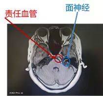四川一女子網上查病,竟解決了十年的大問題 四川一女子網上查病,竟解決了十年的大問題