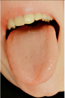 今年是壬寅年，木運過旺之年，與&OpenCurlyDoubleQuote;四季脾旺不受邪&rdquo;