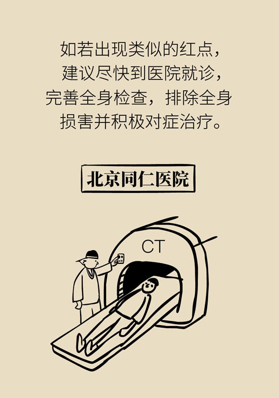 身上出現紅斑、紅點別不當回事，警惕癌變