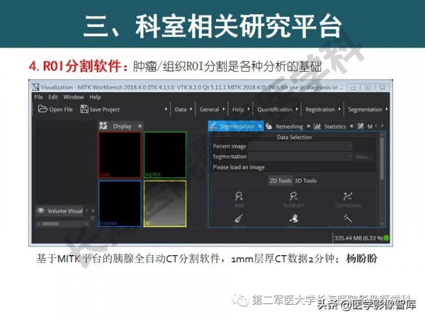 體部DWI共識及胰腺DWI研究經驗介紹