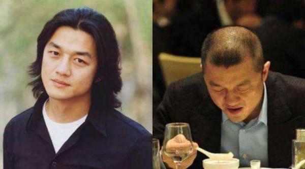 &OpenCurlyDoubleQuote;禿頂&rdquo;危機的9大男神，有人29歲髮際線堪憂，有人戴了多年假髮