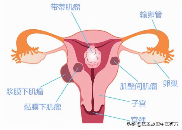 中藥止痛神方,兩味藥泡水,即可祛瘀、止痛、散結,讓你展顏開懷 中藥止痛神方,兩味藥泡水,即可祛瘀、止痛、散結,讓你展顏開懷
