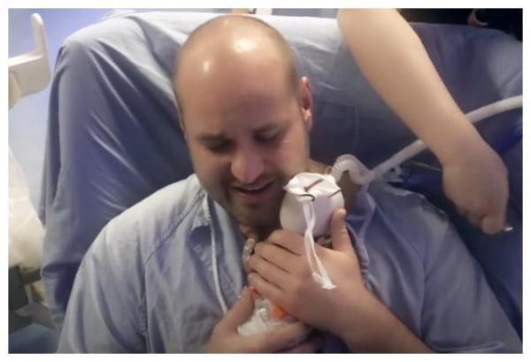 26周早產兒，出生不到1斤只有巴掌大，奇蹟生還長成大美人