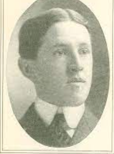 牙齒爛光,臉長巨瘤,骨頭還會發光,被美國資本家逼向絕路的女工 牙齒爛光,臉長巨瘤,骨頭還會發光,被美國資本家逼向絕路的女工