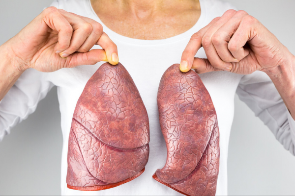 什麼是“肺大皰”？體檢時被查出該怎麼辦？呼吸科醫生道出了真相