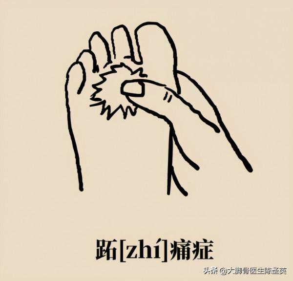 腳底板愛長繭子,走路疼痛到底是怎麼回事? 腳底板愛長繭子,走路疼痛到底是怎麼回事?