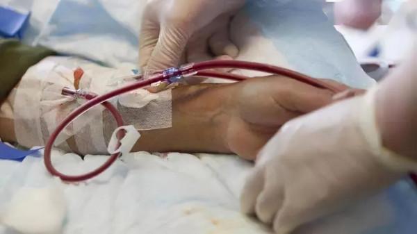 血透患者如何預防內瘻堵塞