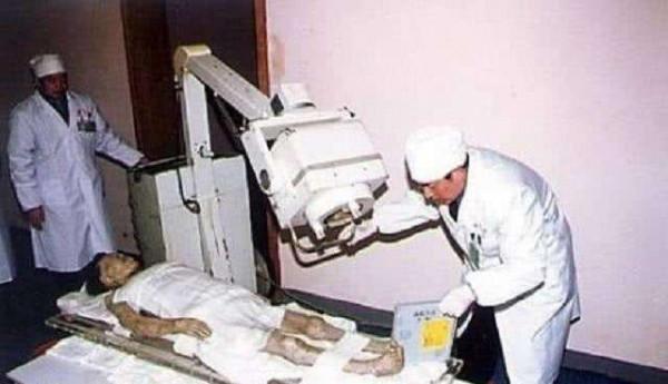 馬王堆女屍的棺液,竟是這幾種成分,千年不腐的秘訣與致命的屍毒 馬王堆女屍的棺液,竟是這幾種成分,千年不腐的秘訣與致命的屍毒