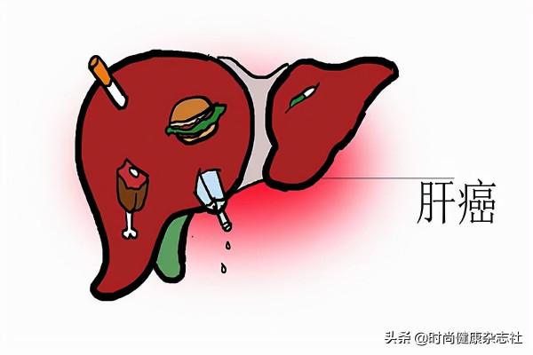 肝癌、控煙、乳腺癌、幽門螺桿菌&period;&period;&period;&period;&period;&period;2022這些&OpenCurlyDoubleQuote;健康熱點&rdquo;仍需關注