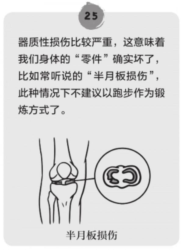 跑步到底會不會傷膝關節,聽聽專家怎麼說 跑步到底會不會傷膝關節,聽聽專家怎麼說