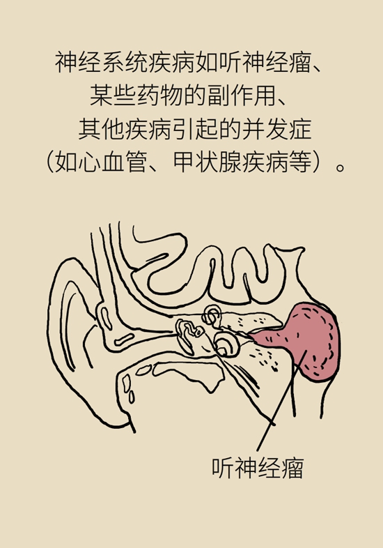 耳鳴是人老了聽力不行了?錯,可能藏著個大病 耳鳴是人老了聽力不行了?錯,可能藏著個大病