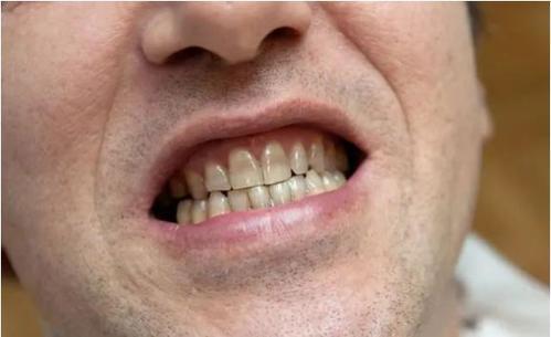 為什麼人一到中年,嘴裡總是“臭烘烘”的?如何去除異味? 為什麼人一到中年,嘴裡總是“臭烘烘”的?如何去除異味?