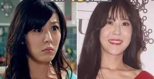 整容失敗的幾位明星