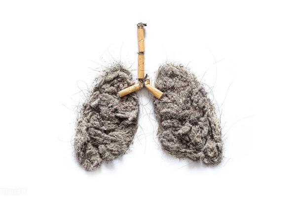 什麼是肺癌的靶向治療？所有肺癌患者都能用嗎？權威醫生解答了