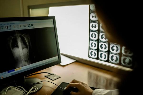 當一位肺癌晚期患者可以多活20個月