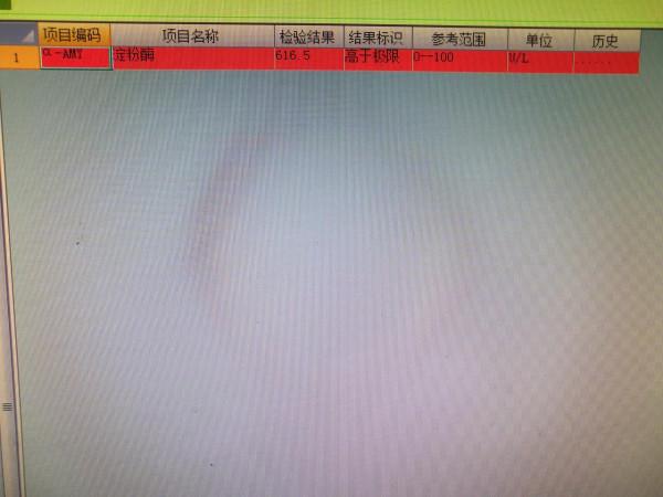 又是熟人惹的禍,急性出血性胰腺炎 又是熟人惹的禍,急性出血性胰腺炎