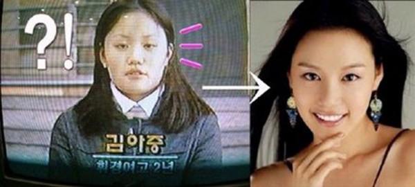 韓流明星整容堪比換頭:蔡妍換臉成功,任娜英李鍾碩鼻子變形 韓流明星整容堪比換頭:蔡妍換臉成功,任娜英李鍾碩鼻子變形