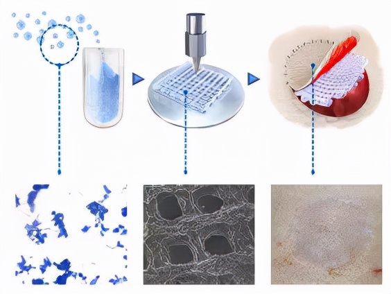 中山大學發表基於ECM的3D列印真皮研發新成果