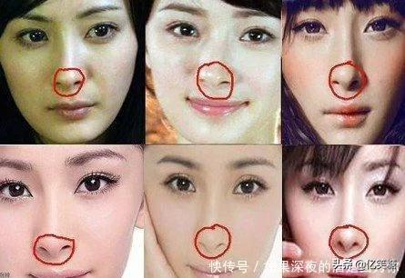 盤點那些娛樂圈一眼能看出整容，卻打死不承認的女星