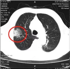 只要活得久就一定會得癌?癌症到底是如何產生的,又為何治療如此複雜 只要活得久就一定會得癌?癌症到底是如何產生的,又為何治療如此複雜