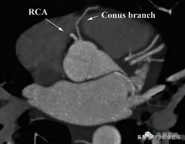 CT斷層解剖圖譜最全總結「推薦收藏」 CT斷層解剖圖譜最全總結「推薦收藏」