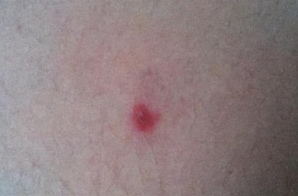 45歲後，進入“疾病爆發期”，醫生：若有五種跡象，建議儘早檢查