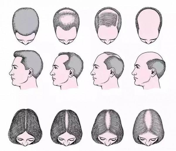 冷知識:原來人一生拉的便便可以這麼重 冷知識:原來人一生拉的便便可以這麼重