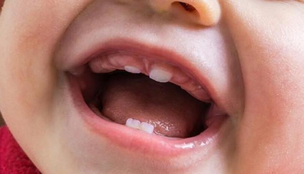 寶寶什麼時候出牙？出牙順序、表現和護理方法是什麼？一文說清