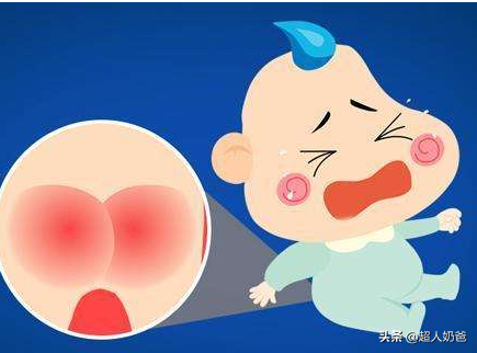 親身攻克紅屁屁的小技巧分享