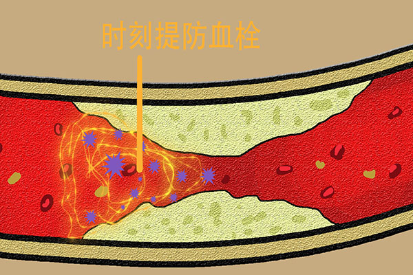睡覺時突然腿抽筋,就是缺鈣?錯!還有這幾個原因,也不要忽視 睡覺時突然腿抽筋,就是缺鈣?錯!還有這幾個原因,也不要忽視